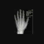 10 Ways AI Is Making Health Insurance Simpler to Understand