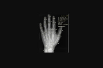 10 Ways AI Is Making Health Insurance Simpler to Understand