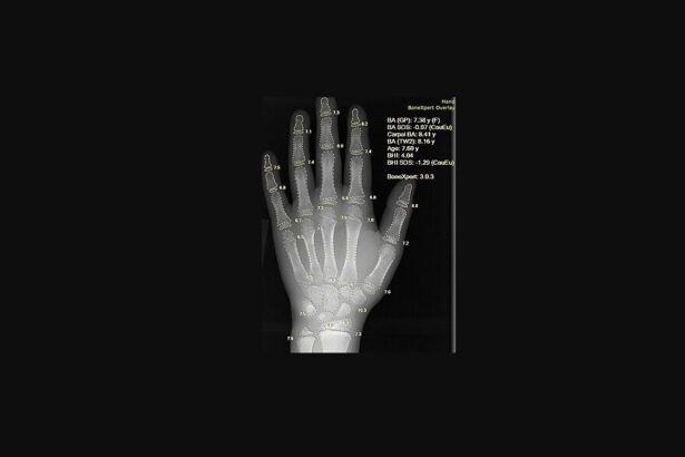 10 Ways AI Is Making Health Insurance Simpler to Understand