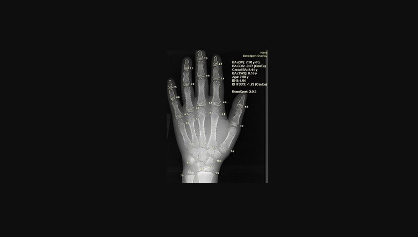 10 Ways AI Is Making Health Insurance Simpler to Understand